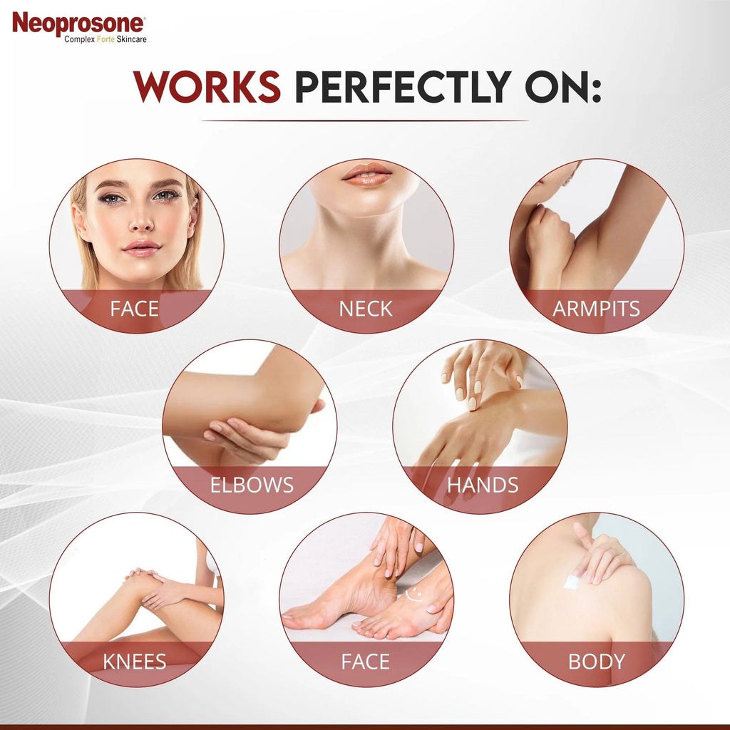 Neoprosone Dark Spot Remover Gel Crème – 30 ml / 1 fl oz